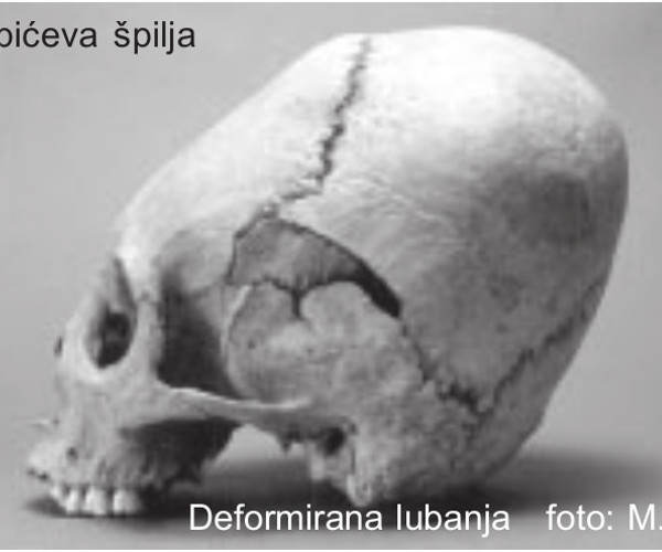 Izdužena lubanja pronađena je 1987. godine, oko 70 metara daleko od jamskog ulaza u Jopića pećinu (Foto: Mario Šlaus; Izvor: ”Subterranea Croatica” (Domagoj Perkić ”Antičke nekropole u špiljama kao posebnost kordunskog područja”), 2003.)