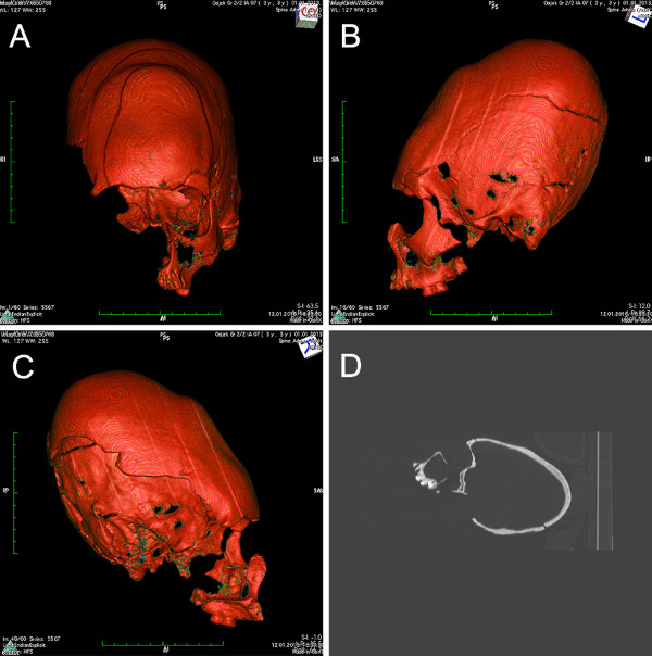 Fotografija izdužene lubanje iz znanstvenog članka https://journals.plos.org/plosone/article?id=10.1371/journal.pone.0216366